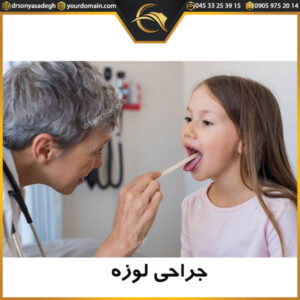جراحی لوزه - دکتر سونیا صادق