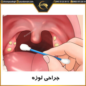 جراحی لوزه - دکتر سونیا صادق