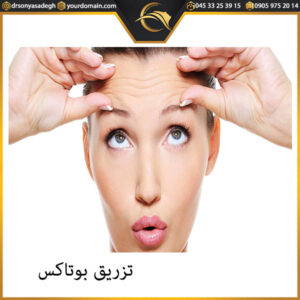 تزریق بوتاکس - دکتر صادق