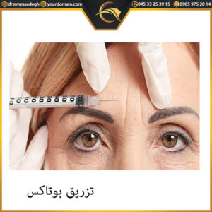 تزریق بوتاکس - دکتر سونیا صادق