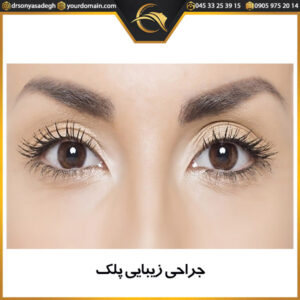 جراحی زیبایی پلک