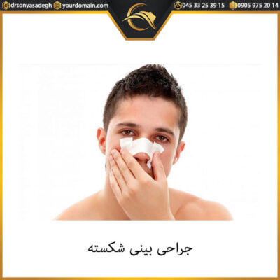 جراحی بینی شکسته - دکتر صادق