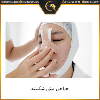 جراحی بینی شکسته - دکتر صادق