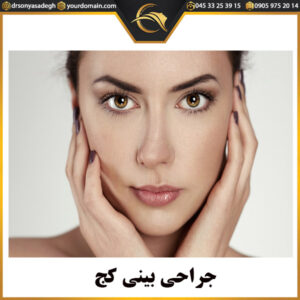 جراحی بینی کج - دکتر سونیا صادق