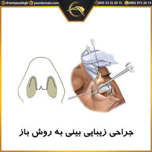 جراحی زیبایی بینی