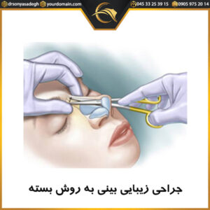 جراحی زیبایی بینی