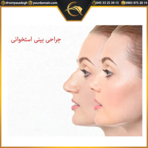 جراحی بینی استخوانی