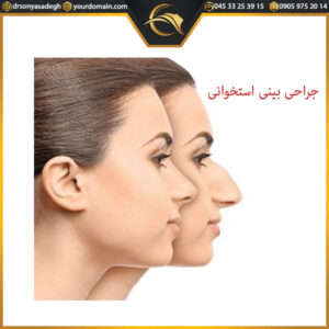 جراحی بینی استخوانی
