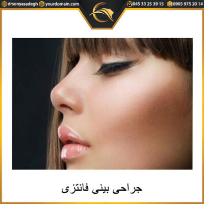 جراحی بینی فانتزی در اردبیل - دکتر سونیا صادق
