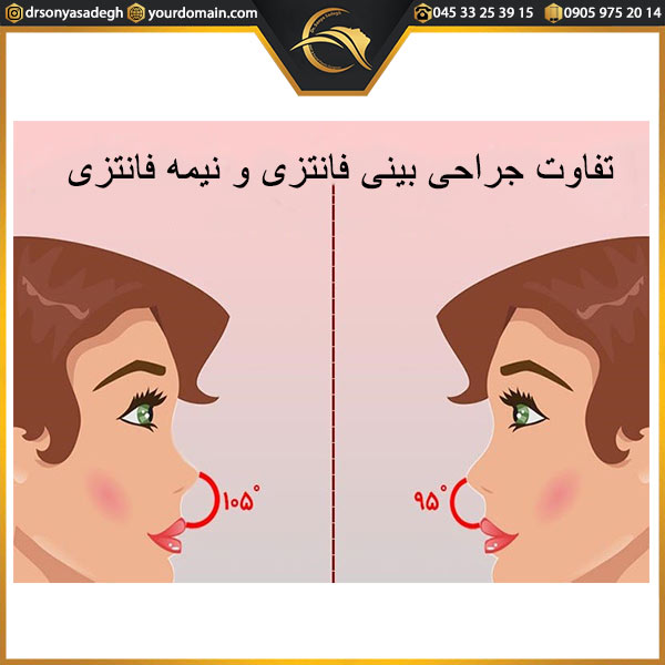 جراحی بینی فانتزی