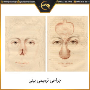 جراحی ترمیمی بینی