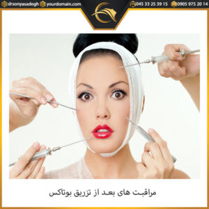 مراقبت های بعد از تزریق بوتاکس