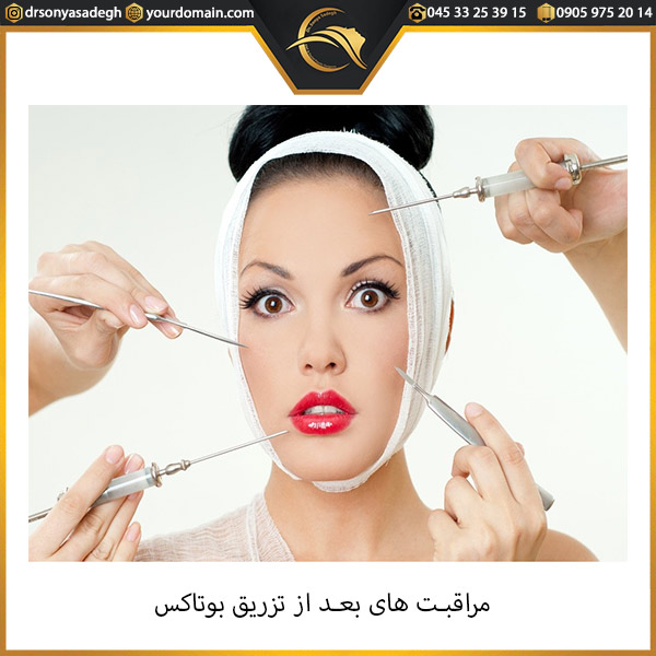 مراقبت های بعد از تزریق بوتاکس
