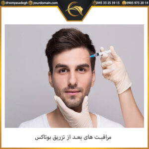 مراقبت های بعد از تزریق بوتاکس