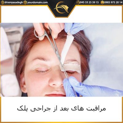 مراقبت های بعد از جراحی پلک - دکتر صادق