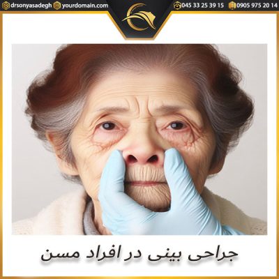 جراحب بینی در افراد مسن - دکتر سونیا صادق