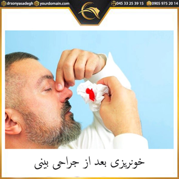 خونریزی بعد از جراحی بینی