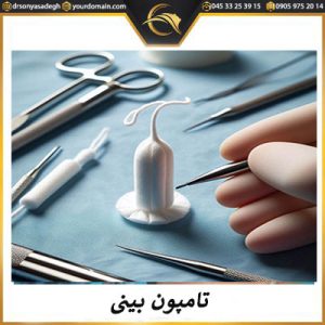 تامپون بینی بعد از جراحی - دکتر سونیا صادق