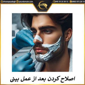 اصلاح صورت بعد از عمل بینی | دکتر سونیا صادق