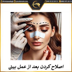 اصلاح ابرو بعد از عمل بینی | دکتر سونیا صادق