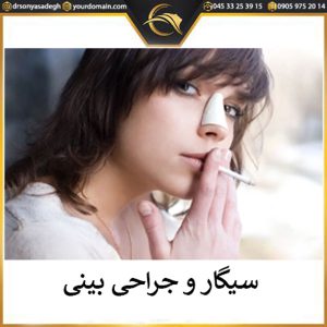 سیگار و جراحی بینی - دکتر سونیا صادق