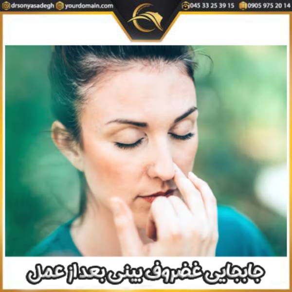 جابجایی غضروف بینی بعد از عمل