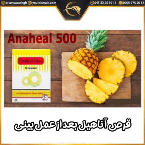 قرص آناهیل بعد از عمل بینی