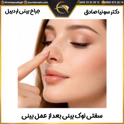 سفتی نوک بینی بعد از عمل بینی