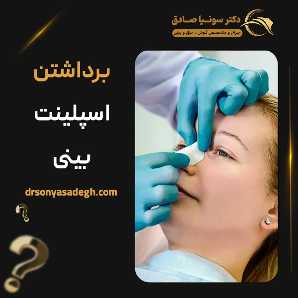 برداشتن اسپلینت بینی - دکتر صادق