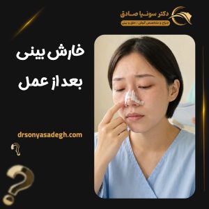 خارش بینی بعد از عمل
