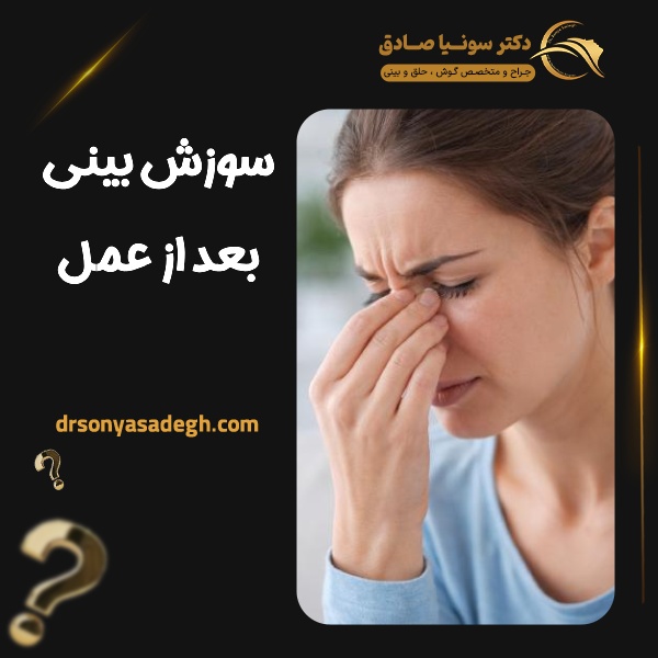 سوزش بینی بعد از عمل