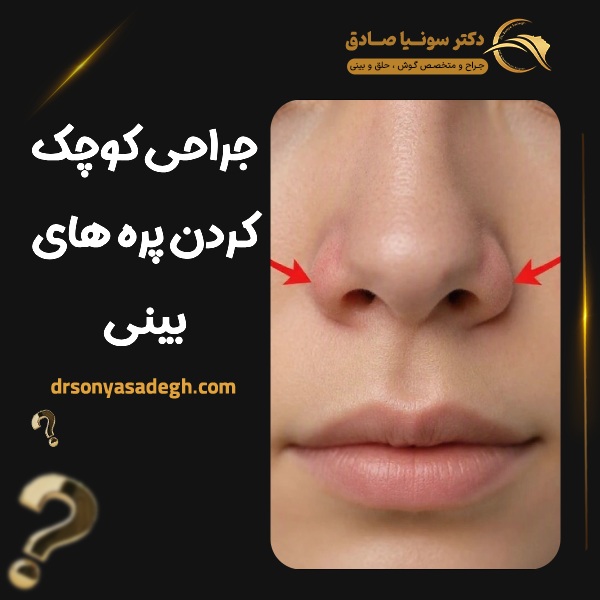 جراحی کوچک کردن پره های بینی