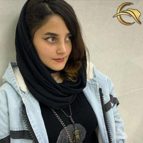 جراحی-بینی-10