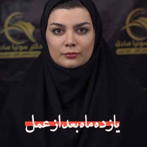 جراحی-بینی-71
